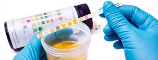 Drug Testing